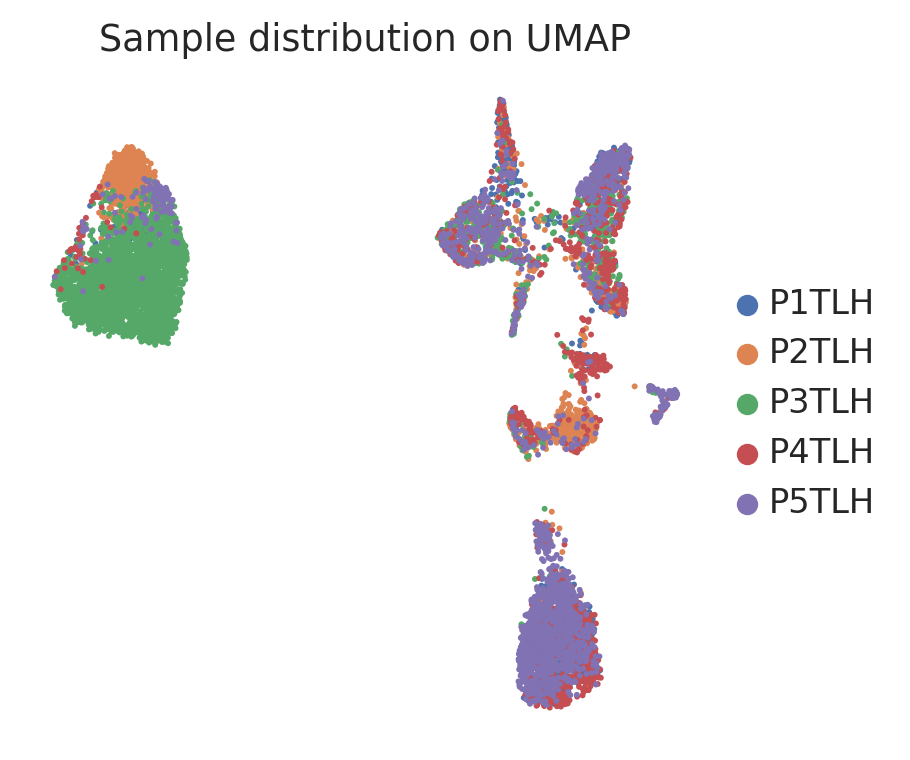 MacParland 人肝脏样本来源 UMAP